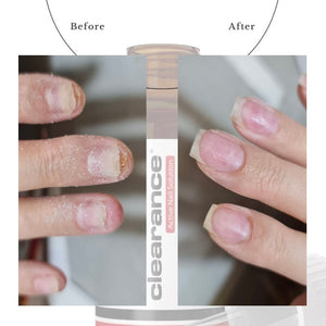 Active Nail Solution Drops