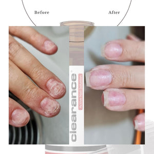 Active Nail Solution Drops