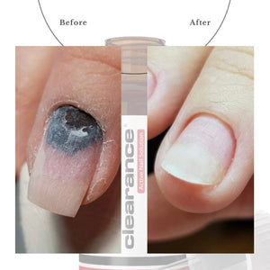 Active Nail Solution Drops